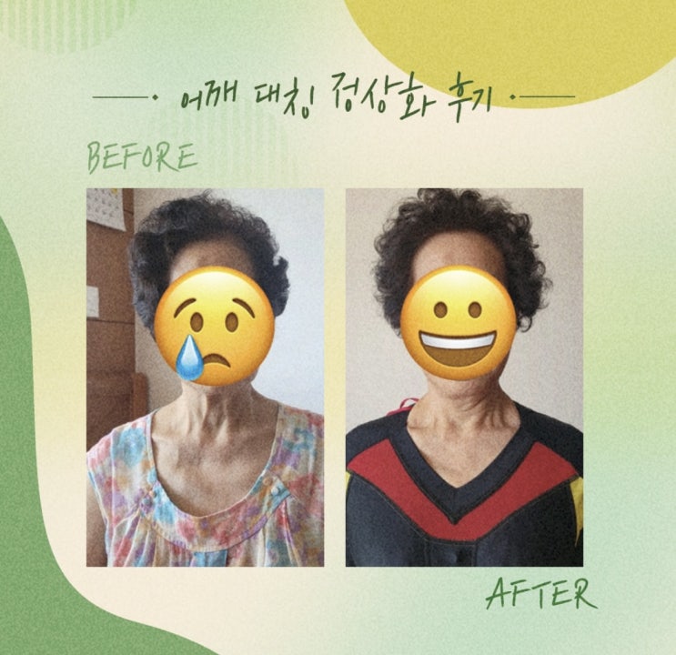  [슬리밍고 고객사례] 어깨 비대칭의 정렬, 어깨 대칭 정상화 후기