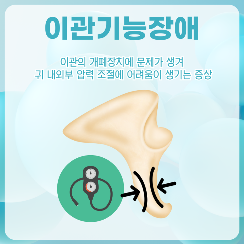 유스타키오관 기능 장애에 대하여 2