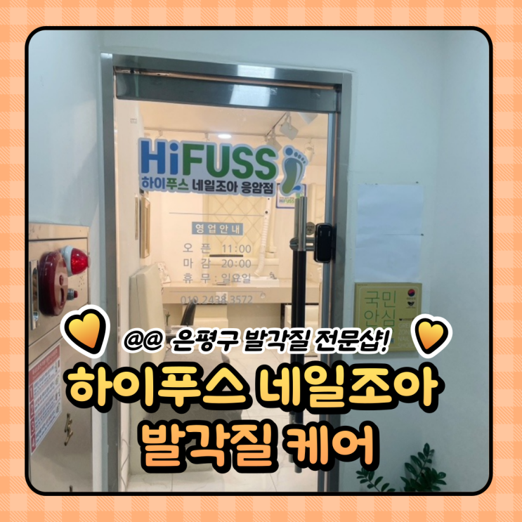  은평구 발각질 내성발톱케어 네일 한번에 하이푸스 네일조아 응암점