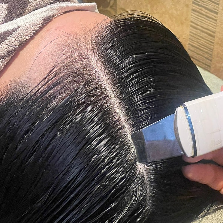  창원두피관리 닥터포레:유분과 각질있는 내 두피..맞춤케어로 예방