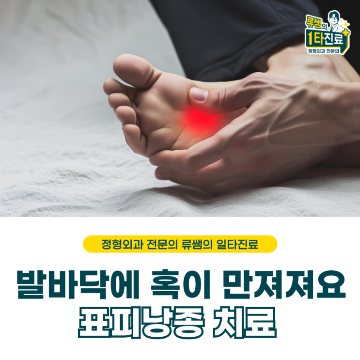  발바닥에 혹이 생겼는데 아파요/표피낭종 치료(의사작성)