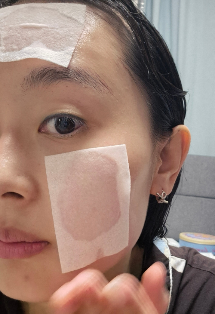  여드름토너 추천 보습화장품 디펜덤 리셋 베리어 에센스 토너(좁쌀여드름 케어방법)