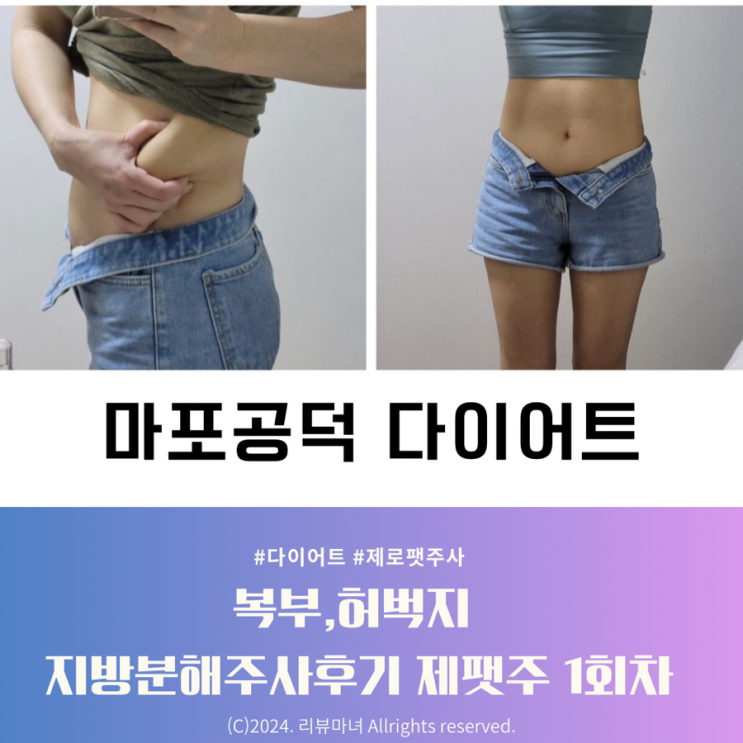  공덕다이어트 복부 허벅지 지방분해주사_제팻주 1회 후기
