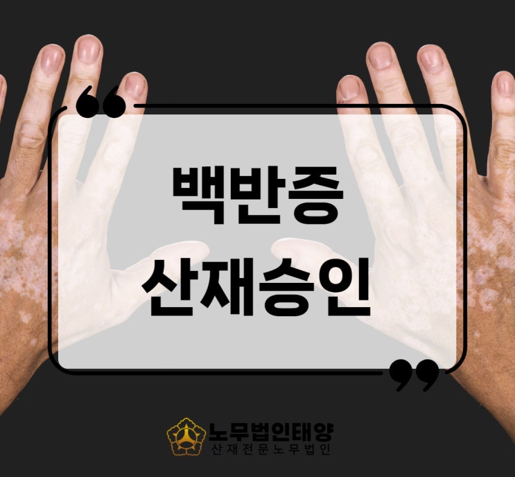  백반증 산재 피부질환 보상 가능합니다. 제조업 승인사례