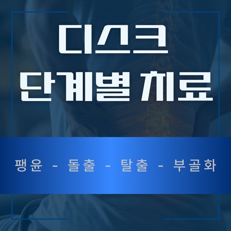  허리디스크 통증 단계별 특징 증세와 치료 방법