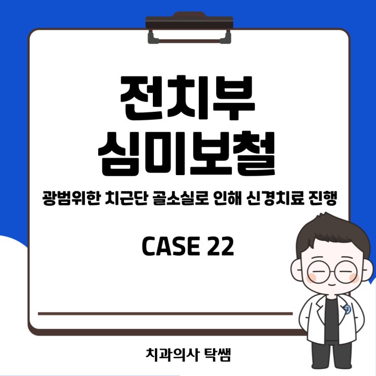  [탁쌤 CASE 22] 청주 사창동 앞니 신경치료 후 심미적 크라운 진행