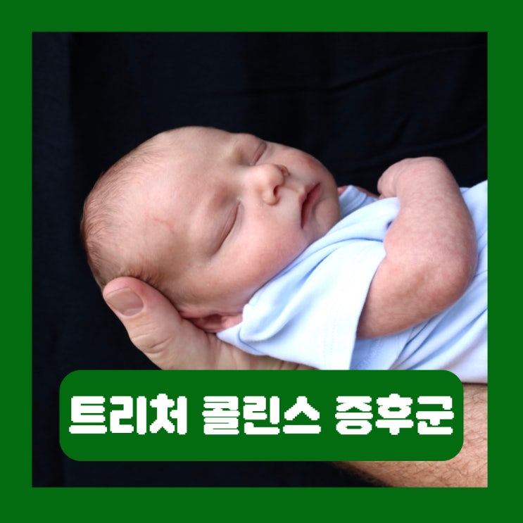  트리처 콜린스 증후군 원인 증상 수술 치료 나이