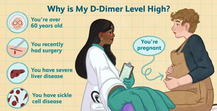  D dimer 검사 수치와 보험 적용 기준