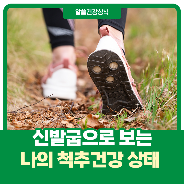  신발굽이 말해주는 나의 척추건강!