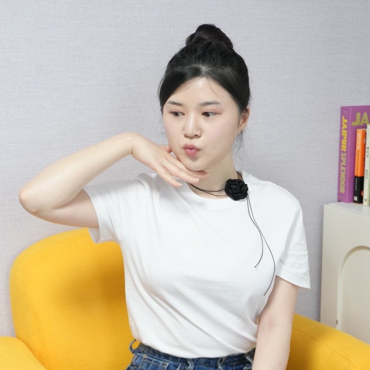  팔자필러보다 자연스러운  스컬트라 뭉침없는 4주 후기