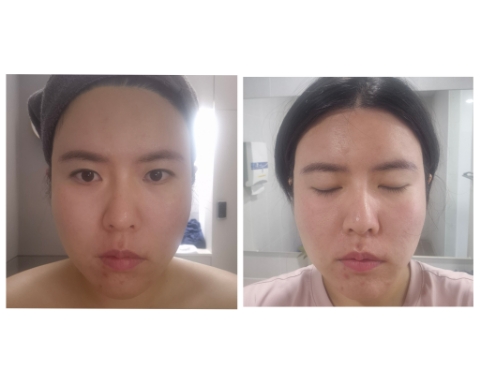  광명피부관리 잘하는 수분탄력 전문 결이고은광명점
