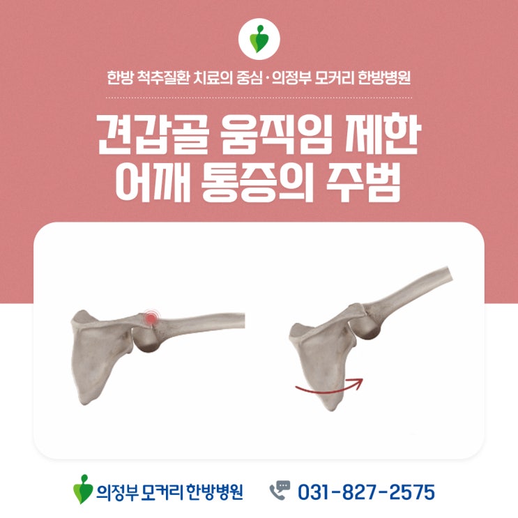  포천의정부 한방병원 견갑골 움직임 제한, 어깨 통증의 주범