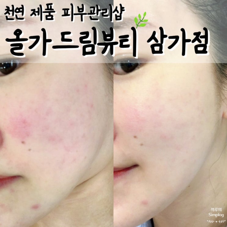  [용인/삼가] 허브 성분의 천연제품으로 모공청소와 진정관리까지 : 올가드림뷰티 삼가점