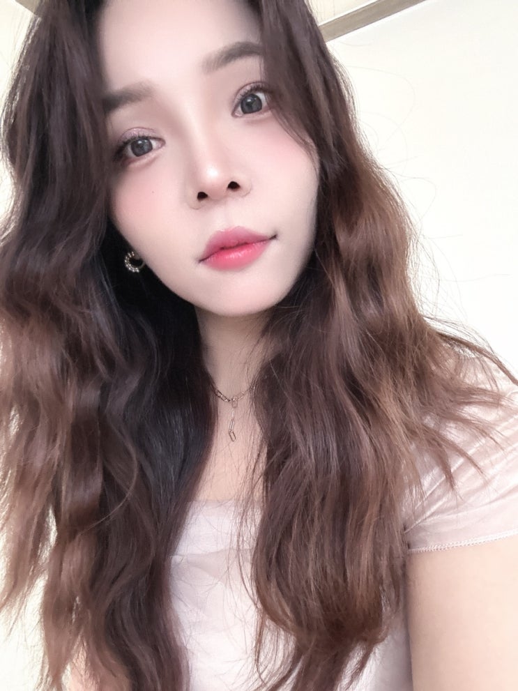  가넷성형외과 내돈내산 대공사 후기 3탄 ! 수술 한달반 경과 !