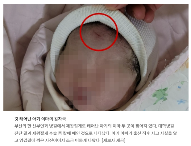  제왕절개 칼자국 사고, 어이 없는 병원 대응