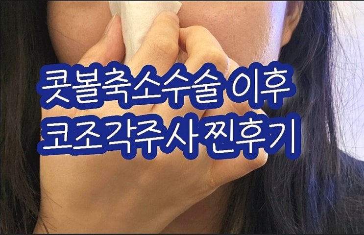 콧망울축소 코조각주사 내돈내산 찐 후기 (반영구,효과,붓기)