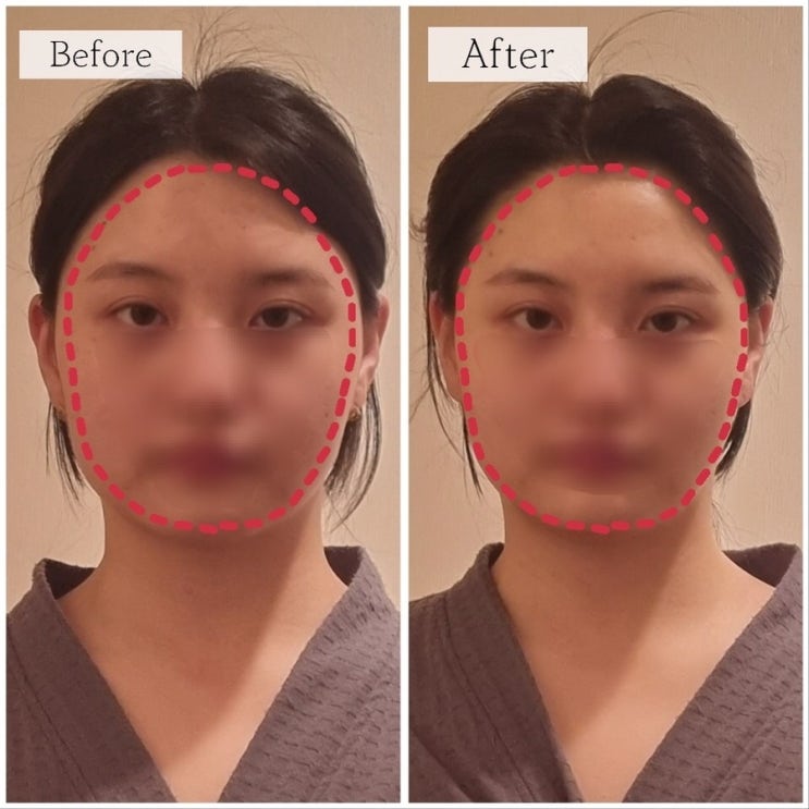 대구동구피부관리샵 율하동 #소중한내피부 _ 새얼굴테라피로 얼굴 윤곽 잡아준 후기 대구동구피부관리샵 율하동 #소중한내피부 _ 새얼굴테라피로 얼굴 윤곽 잡아준 후기