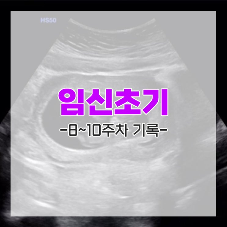  임신 8주차 9주차 10주차 초음파 태아 배 상태 기록