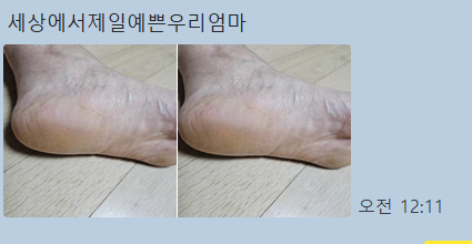  발각질제거팩 추천 매드포코스 발팩 엄마 효도템으로 굿