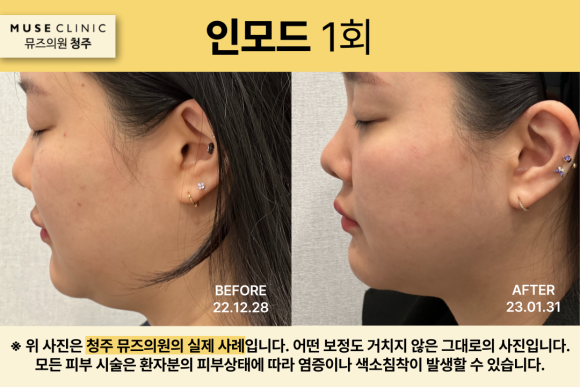 청주인 모드 효과? 두 가지만 알아두세요