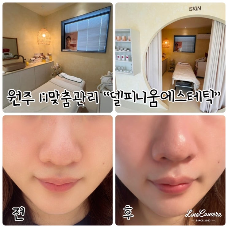  최상급 제품 및 기기만을 엄선해 사용하는 원주 프리미엄 1인 에스테틱 “델피니움에스테틱”