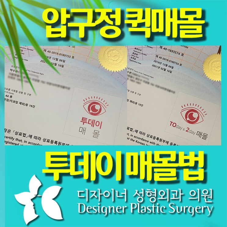  압구정 퀵매몰 쌍꺼풀 당일 실밥 제거 가능한 곳의 후기