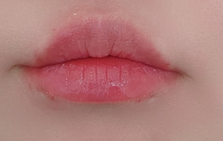  청담 피부관리 삼각입술 내돈내산 입술필러, 입술필러 전후 사진 및 후기