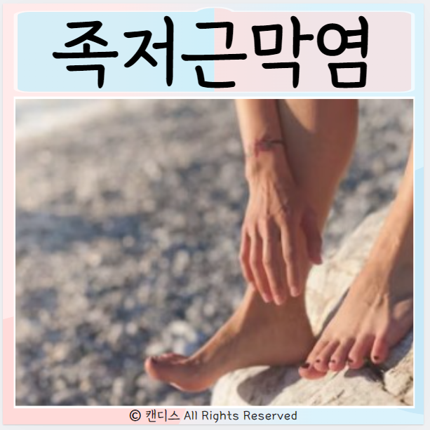  족저근막염 관리 치료 증상 원인