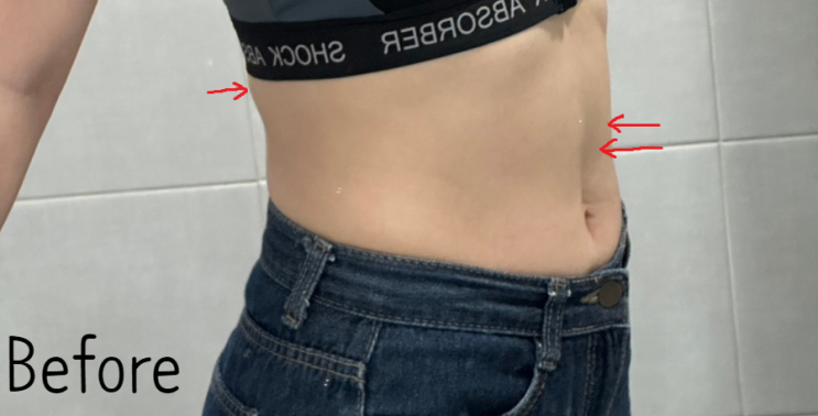 범계 다이어트 한의원 살이 쭉쭉 빠지는 후기 공개 범계 다이어트 한의원 살이 쭉쭉 빠지는 후기 공개