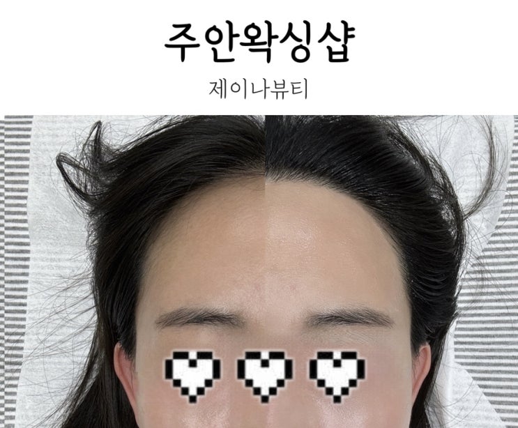  웨딩촬영 필수 헤어라인왁싱 주안왁싱샵 추천 후기