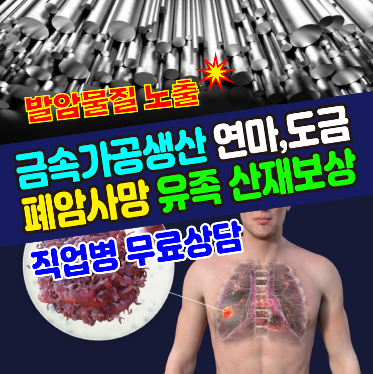  [직업병 무료상담] 금속가공생산(연마,도금) 폐암사망 유족 산재보상