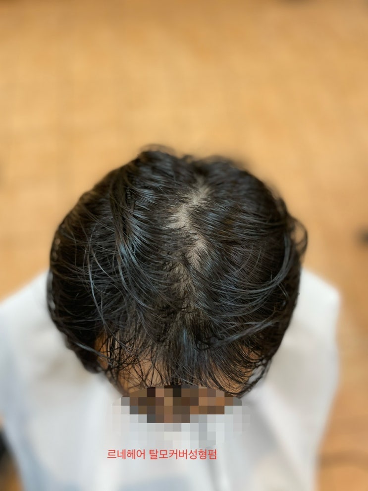  탈모펌 경계 그 선을 넘다 부산탈모헤어클리닉전문미용실 르네시떼6층 사상홈플러스7층/ 경남경북남해전라전북충남충북강원경기서울제주대구구미거제김해진주창원마산밀양경주양산
