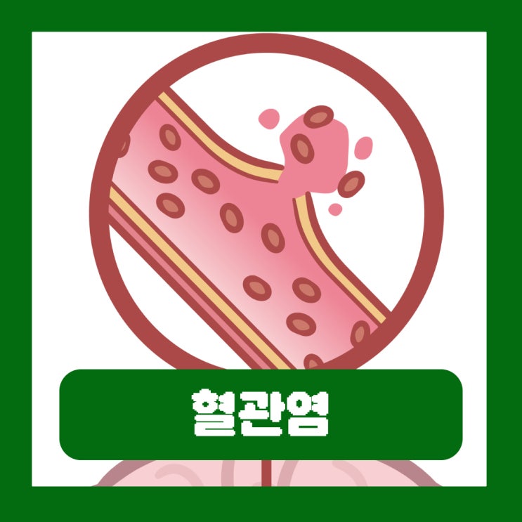  혈관염 원인 증상 다리 피부 자반증 검사 치료 약 자가면역질환