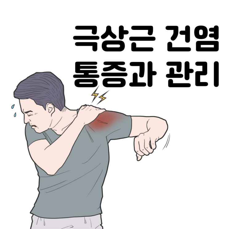  극상근 건염과 통증 관리: 효과적인 어깨 재활 운동법과 예방법