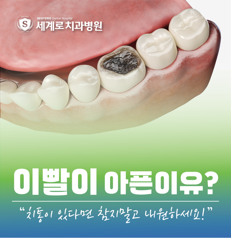  이빨이 아픈 이유? 치아 통증별 원인과 대처법