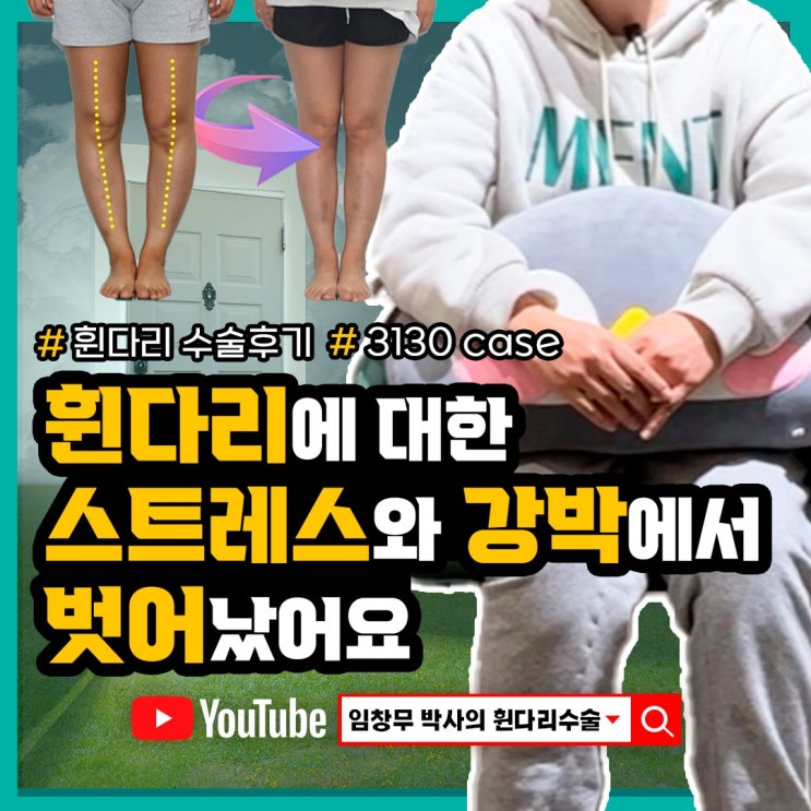 휜다리에 대한 스트레스와 강박증 벗어났어요 | 근위경골절골술
