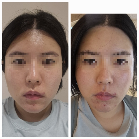  신중동피부관리 잘하는 오션에스테틱에서 물광피부만들기