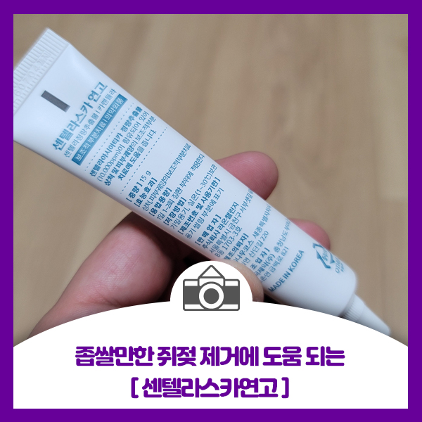  좁쌀만한 쥐젖 제거에 도움 되는 센텔라스카연고