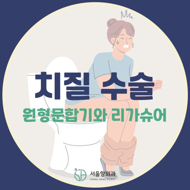  나에게 맞는 치질수술 방법은? | 지축역 치질