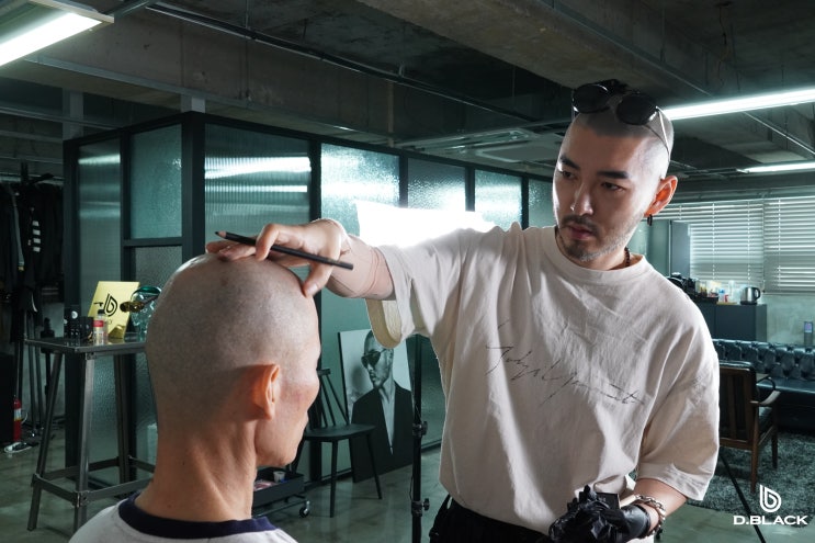  탈모, 두피플랜팅 모르면 손해보는 정보들 : 가격, 장점, 종류, 효과 등