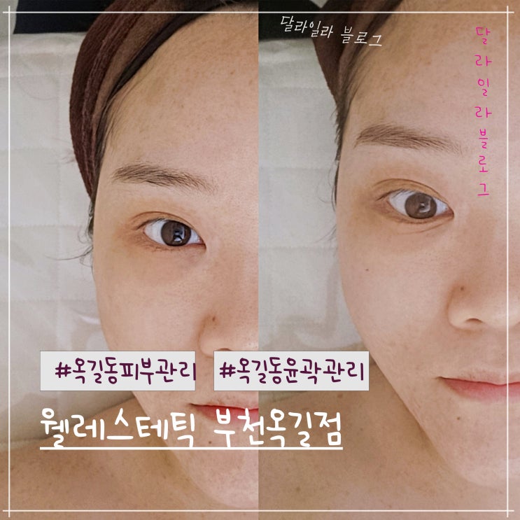  옥길동피부관리는 웰레스테틱 부천옥길점 윤곽관리까지 잘하다니