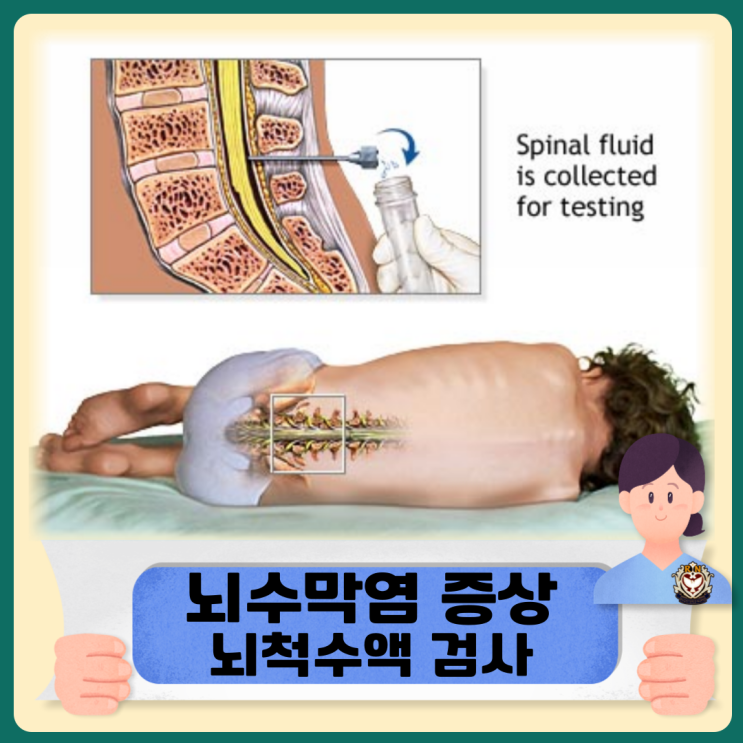  뇌수막염 증상 원인 및 뇌척수액 검사 진단방법