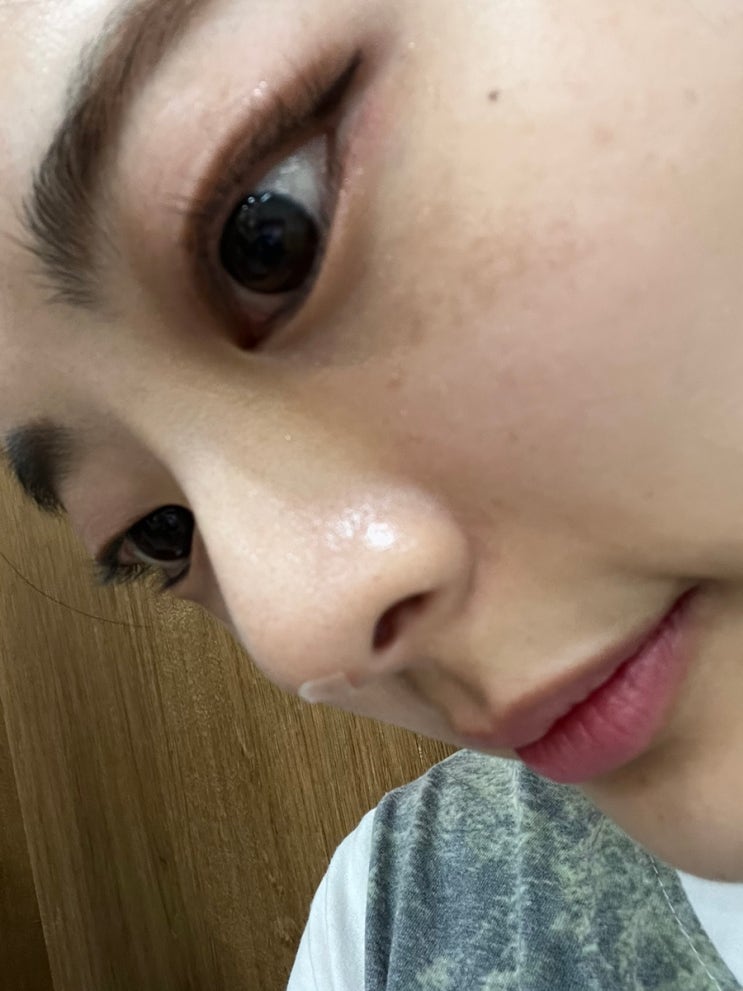 유지기간 대박인 ‘비너스코’ 시술 후기