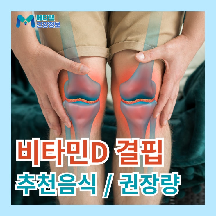  비타민D결핍 부족증상 하루권장량 섭취시간 비타민D 풍부한 음식까지