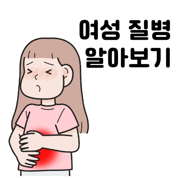  여성 건강: 다낭성 난소 증후군, 자궁내막증, 자궁경부암의 원인과 치료