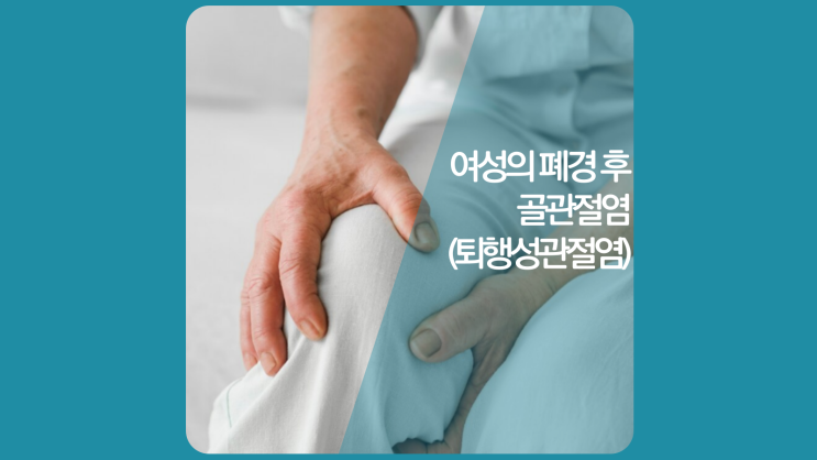  인천정형외과 여성호르몬(폐경)과 뼈 건강. 골관절염 체크리스트
