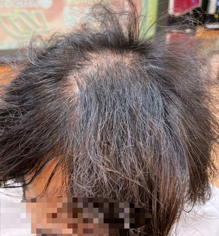  부산탈모펌 잘하는미용실 사상르네시떼6층 탈모성형펌으로 환승