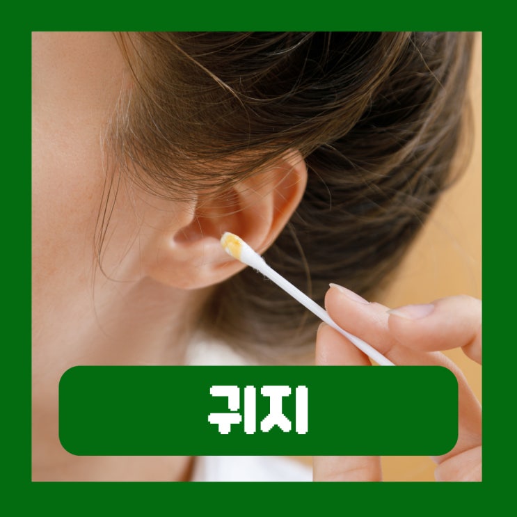  귀지 제거 이비인후과 젖은 소리 원인 역할 왜 생길까