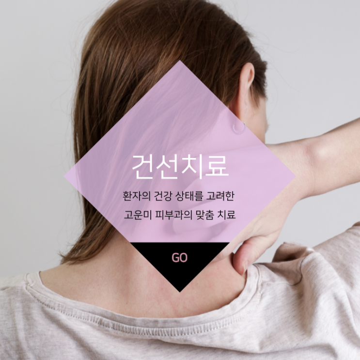  대구반월당건선치료 증상을 완화시키고 관리하는 것이 중요합니다