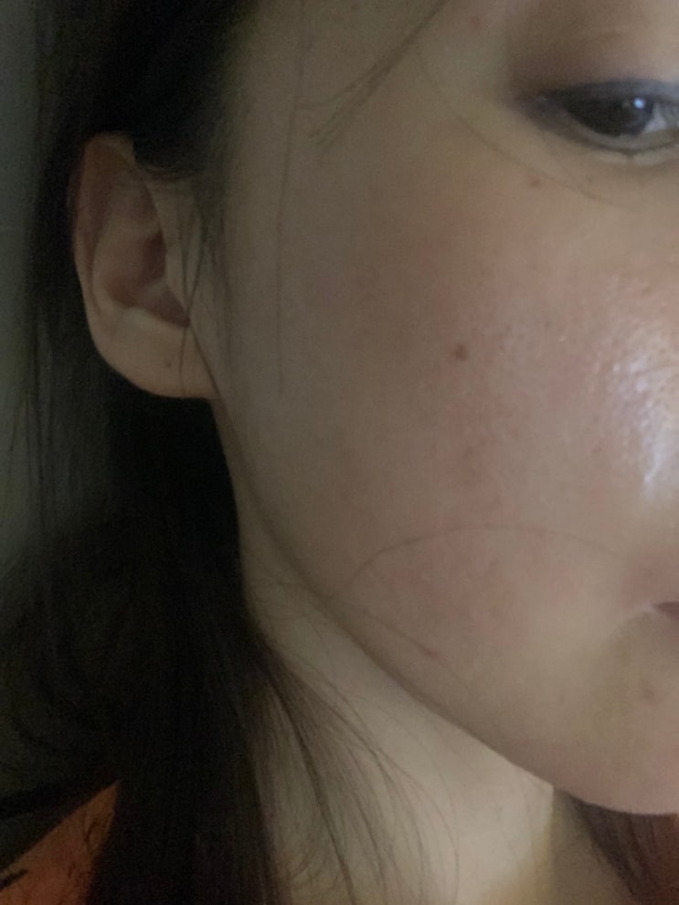  올리브영 비건이펙트 청보리 한달 후기 내돈내산 좁쌀여드름 고민인 사람 이렇게만 해보세요 싹사라짐
